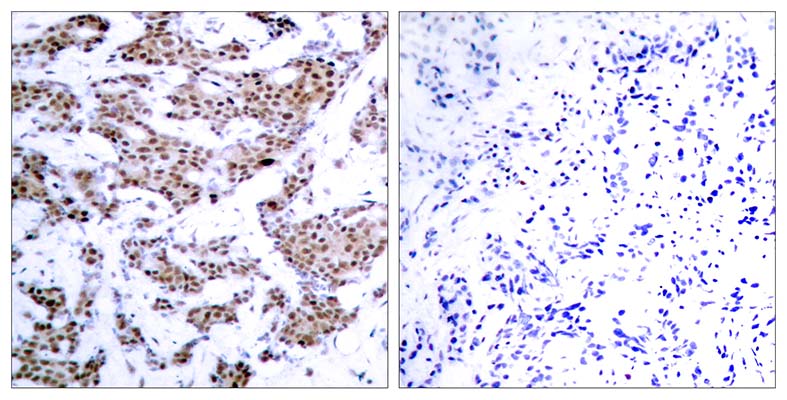 MEF-2 (phospho Thr312) Rabbit Polyclonal Antibody | 兔多抗 | EnkiLife恩玑生命
