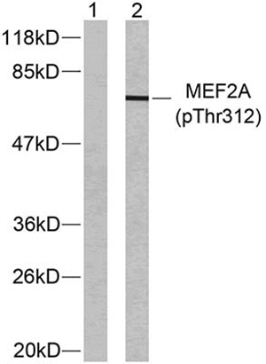 MEF-2 (phospho Thr312) Rabbit Polyclonal Antibody | 兔多抗 | EnkiLife恩玑生命