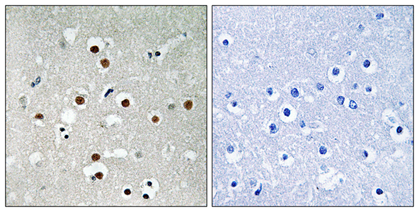 MEF-2C (phospho Ser396) Rabbit Polyclonal Antibody | 兔多抗 | EnkiLife恩玑生命