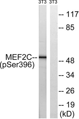 MEF-2C (phospho Ser396) Rabbit Polyclonal Antibody | 兔多抗 | EnkiLife恩玑生命