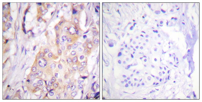MEK-1 (phospho Thr286) Rabbit Polyclonal Antibody | 兔多抗 | EnkiLife恩玑生命