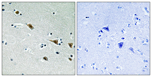 MEK-7 (phospho Ser271) Rabbit Polyclonal Antibody | 兔多抗 | EnkiLife恩玑生命