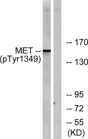 Met (phospho Tyr1349) Rabbit Polyclonal Antibody | 兔多抗 | EnkiLife恩玑生命