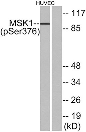 MSK1 (phospho Ser376) Rabbit Polyclonal Antibody | 兔多抗 | EnkiLife恩玑生命