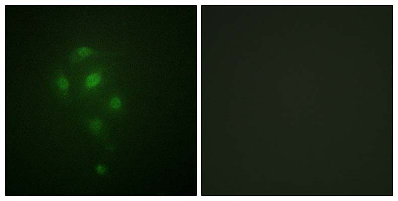 MSK1 (phospho Thr581) Rabbit Polyclonal Antibody | 兔多抗 | EnkiLife恩玑生命