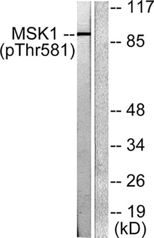 MSK1 (phospho Thr581) Rabbit Polyclonal Antibody | 兔多抗 | EnkiLife恩玑生命
