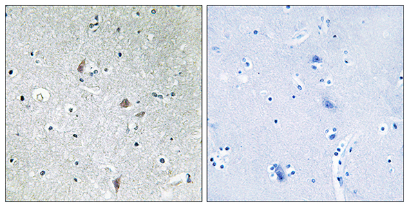 mTOR (phospho Ser2448) Rabbit Polyclonal Antibody | 兔多抗 | EnkiLife恩玑生命