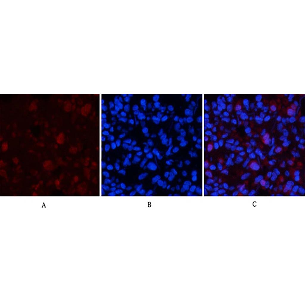 mTOR (phospho Ser2448) Rabbit Polyclonal Antibody | 兔多抗 | EnkiLife恩玑生命