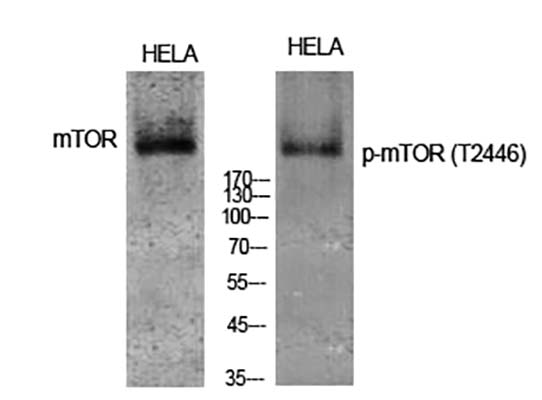 mTOR (phospho Thr2446) Rabbit Polyclonal Antibody | 兔多抗 | EnkiLife恩玑生命