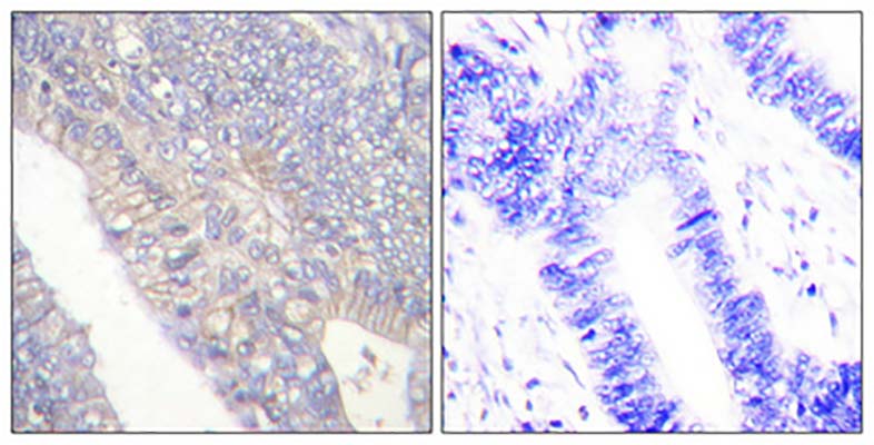 NBK (phospho Thr33) Rabbit Polyclonal Antibody | 兔多抗 | EnkiLife恩玑生命