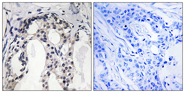 NF2 (phospho Ser10) Rabbit Polyclonal Antibody | 兔多抗 | EnkiLife恩玑生命