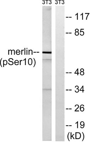 NF2 (phospho Ser10) Rabbit Polyclonal Antibody | 兔多抗 | EnkiLife恩玑生命
