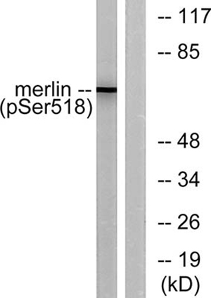 NF2 (phospho Ser518) Rabbit Polyclonal Antibody | 兔多抗 | EnkiLife恩玑生命