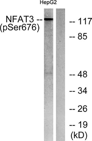 NFATc4 (phospho Ser676) Rabbit Polyclonal Antibody | 兔多抗 | EnkiLife恩玑生命