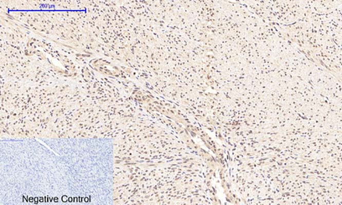 NFκB-p65 (phospho Ser276) Rabbit Polyclonal Antibody | 兔多抗 | EnkiLife恩玑生命