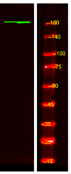 PDGF Receptor α (phospho-Tyr1018) Rabbit Polyclonal Antibody | 兔多抗 | EnkiLife恩玑生命
