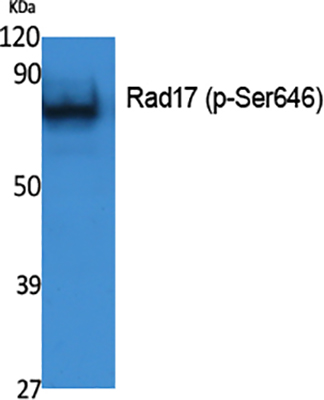 Rad17 (phospho Ser646) Rabbit Polyclonal Antibody | 兔多抗 | EnkiLife恩玑生命