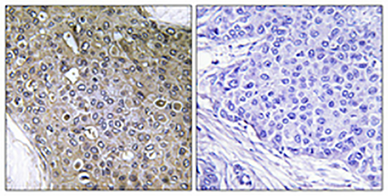 TGFβ RIII (phospho Thr842) Rabbit Polyclonal Antibody | 兔多抗 | EnkiLife恩玑生命