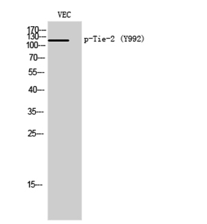 Tie-2 (phospho Tyr992) Rabbit Polyclonal Antibody | 兔多抗 | EnkiLife恩玑生命