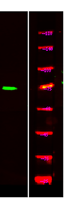 TORC1/CRTC1 (phospho-Ser151) Rabbit Polyclonal Antibody | 兔多抗 | EnkiLife恩玑生命