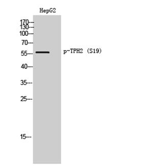 TPH2 (phospho Ser19) Rabbit Polyclonal Antibody | 兔多抗 | EnkiLife恩玑生命