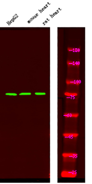 FKHR (Phospho-Ser249) Rabbit Polyclonal Antibody | 兔多抗 | EnkiLife恩玑生命