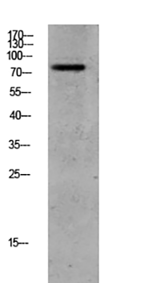 GRK2 (Phospho-Ser685) Rabbit Polyclonal Antibody | 兔多抗 | EnkiLife恩玑生命