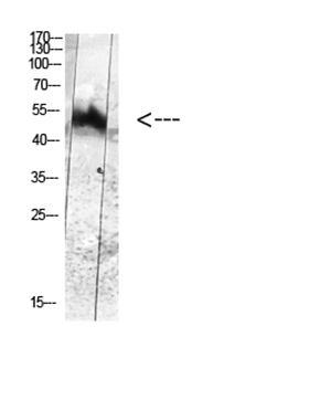 MDM2 (Phospho-Tyr394) Rabbit Polyclonal Antibody | 兔多抗 | EnkiLife恩玑生命