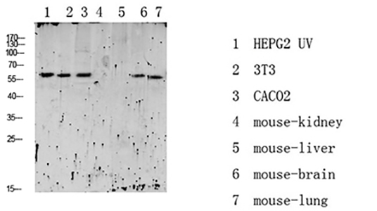 RIPK2 (Phospho-Ser176) Rabbit Polyclonal Antibody | 兔多抗 | EnkiLife恩玑生命