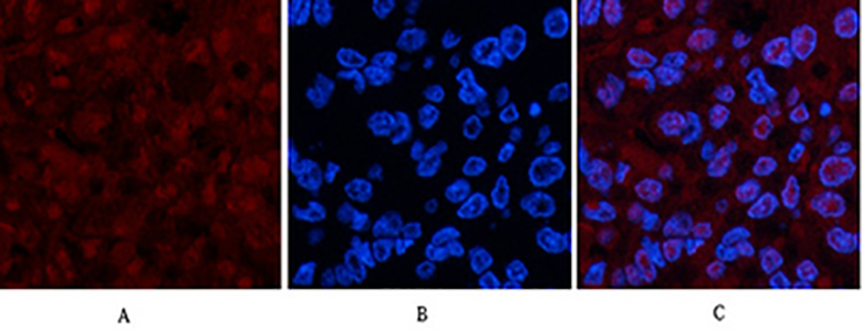 p53 (Di Methyl Lys370) Rabbit Polyclonal Antibody | 兔多抗 | EnkiLife恩玑生命