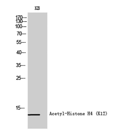 Histone H4 (Acetyl Lys12) Rabbit Polyclonal Antibody | 兔多抗 | EnkiLife恩玑生命