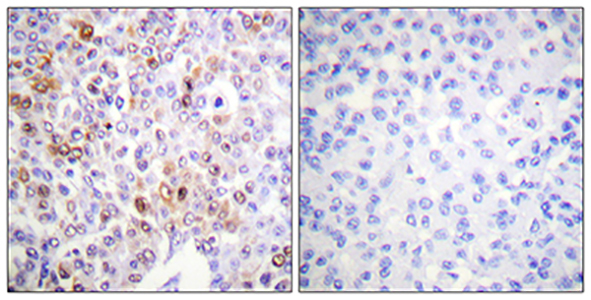 Histone H4 (Acetyl Lys16) Rabbit Polyclonal Antibody | 兔多抗 | EnkiLife恩玑生命