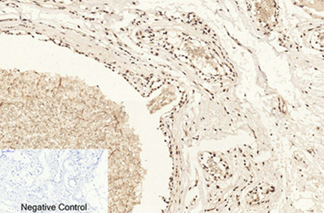 Histone H4 (Acetyl Lys16) Rabbit Polyclonal Antibody | 兔多抗 | EnkiLife恩玑生命