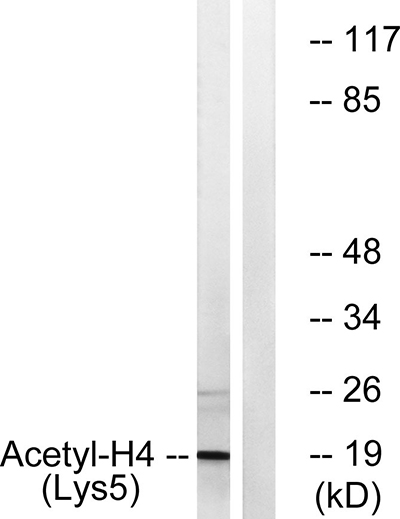 Histone H4 (Acetyl Lys5) Rabbit Polyclonal Antibody | 兔多抗 | EnkiLife恩玑生命