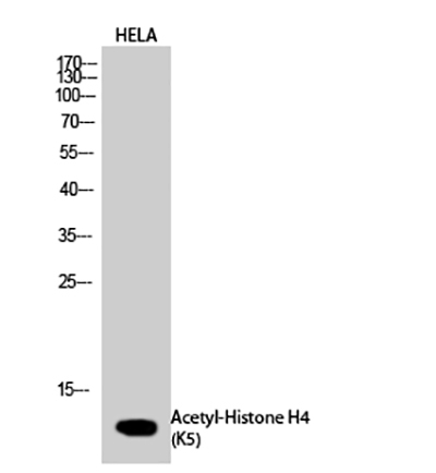 Histone H4 (Acetyl Lys5) Rabbit Polyclonal Antibody | 兔多抗 | EnkiLife恩玑生命