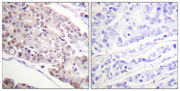 Histone H4 (Acetyl Lys8) Rabbit Polyclonal Antibody | 兔多抗 | EnkiLife恩玑生命