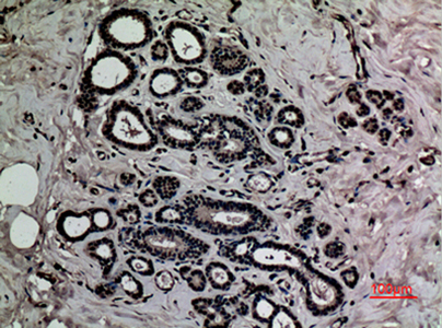 HMG-1 (Acetyl Lys12) Rabbit Polyclonal Antibody | 兔多抗 | EnkiLife恩玑生命