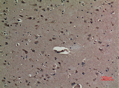 HMG-1 (Acetyl Lys12) Rabbit Polyclonal Antibody | 兔多抗 | EnkiLife恩玑生命