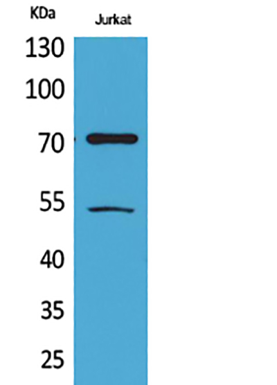 Ku-70 (Acetyl Lys539) Rabbit Polyclonal Antibody | 兔多抗 | EnkiLife恩玑生命