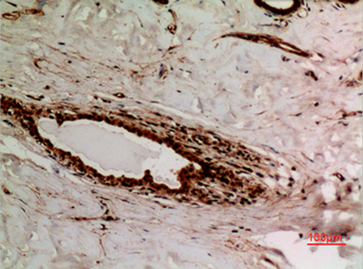 Ku-70 (Acetyl Lys539) Rabbit Polyclonal Antibody | 兔多抗 | EnkiLife恩玑生命