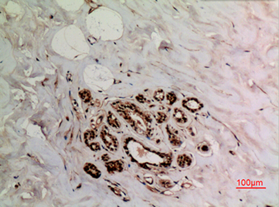 Ku-70 (Acetyl Lys539) Rabbit Polyclonal Antibody | 兔多抗 | EnkiLife恩玑生命