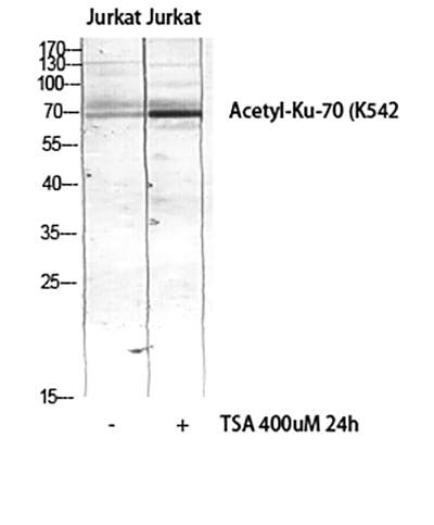 Ku-70 (Acetyl Lys542) Rabbit Polyclonal Antibody | 兔多抗 | EnkiLife恩玑生命