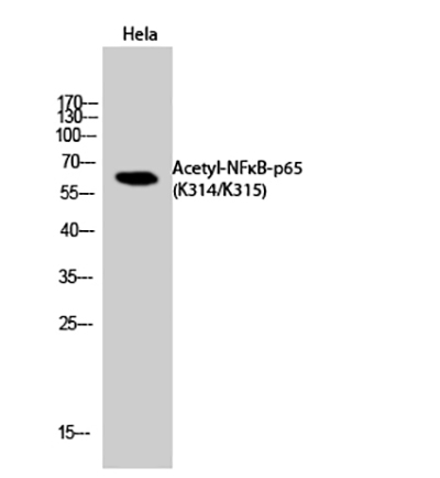 NFκB-p65 (Acetyl Lys314/Lys315) Rabbit Polyclonal Antibody | 兔多抗 | EnkiLife恩玑生命