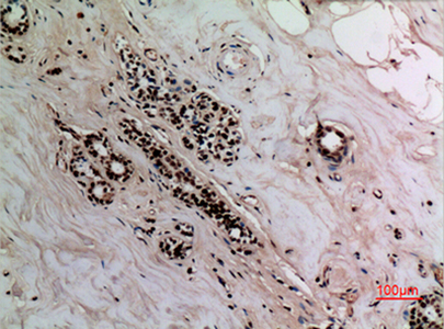 NFκB-p65 (Acetyl Lys314/Lys315) Rabbit Polyclonal Antibody | 兔多抗 | EnkiLife恩玑生命