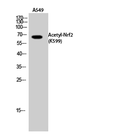 Nrf2 (Acetyl Lys599) Rabbit Polyclonal Antibody | 兔多抗 | EnkiLife恩玑生命