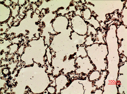 Nrf2 (Acetyl Lys599) Rabbit Polyclonal Antibody | 兔多抗 | EnkiLife恩玑生命