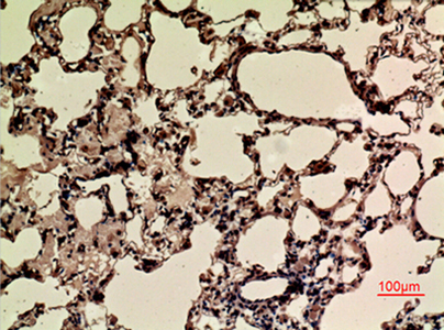 Nrf2 (Acetyl Lys599) Rabbit Polyclonal Antibody | 兔多抗 | EnkiLife恩玑生命