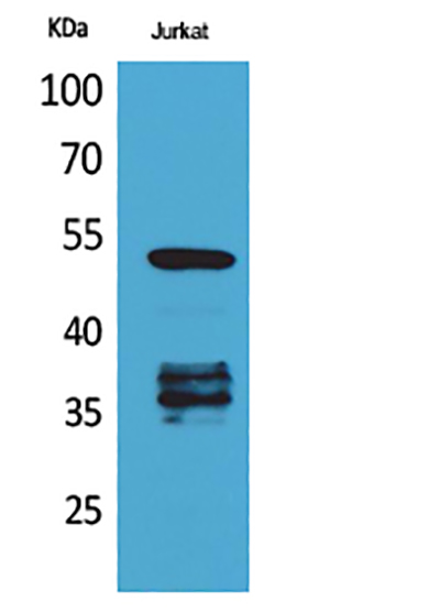 p53 (Acetyl Lys370) Rabbit Polyclonal Antibody | 兔多抗 | EnkiLife恩玑生命