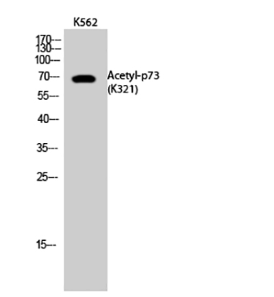 p73 (Acetyl Lys321) Rabbit Polyclonal Antibody | 兔多抗 | EnkiLife恩玑生命