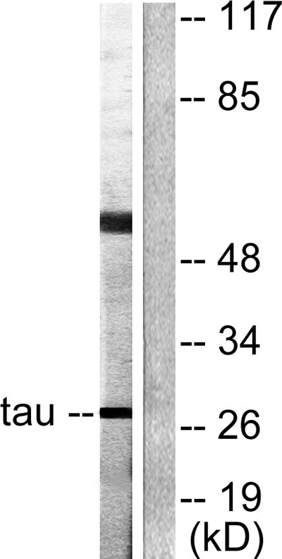 14-3-3 θ/τ Rabbit Polyclonal Antibody | 兔多抗 | EnkiLife恩玑生命
